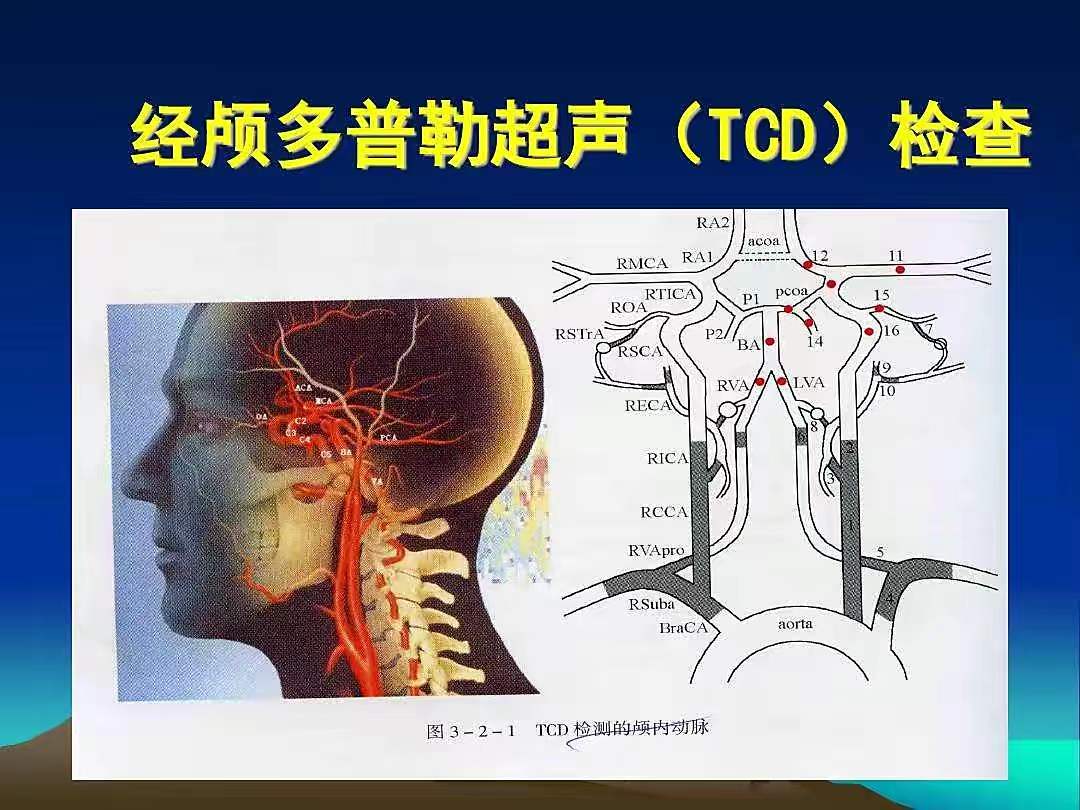 什么是经颅多普勒检查(tcd),曲靖市妇幼保健院